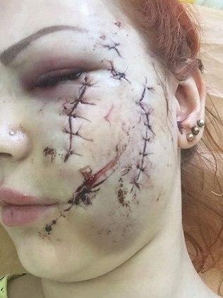 Mulher ficou com rosto cortado (CrÃ©dito: Irina Malysheva)