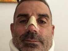 Goleiro atingido por Cristiano Ronaldo vai ficar duas semanas fora