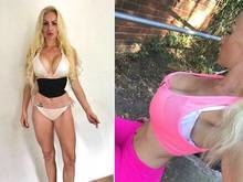 Obcecada pela Barbie vai pagar R$ 76 mil para remover 6 costelas