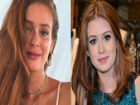 Mariana Ruy Barbosa é acusada de fazer preenchimento labial