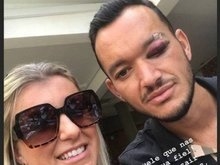 Mulher de Réver publica foto do zagueiro com olho inchado