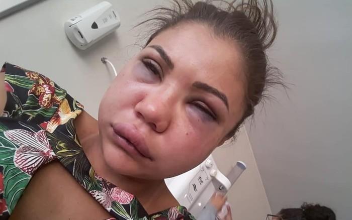 Laiane dos Santos foi espancada pelo namorado  (Crédito: Reprodução/ Facebook )