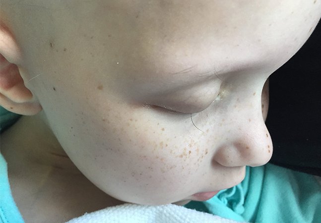 Pai registra o último cílio da filha com câncer e comove a web