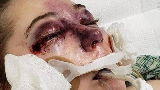 Adolescente 'chora sangue' após contrair misteriosa doença durante cruzeiro (Crédito: Reprodução/Facebook)