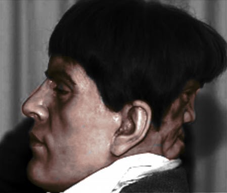 Edward Mordake: conheça a história do homem de duas cabeças