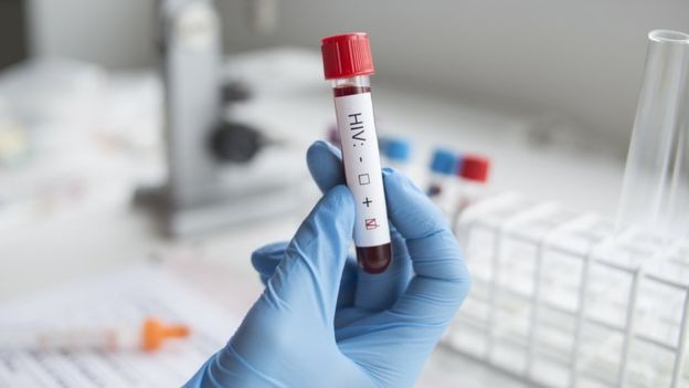 Teste de HIV