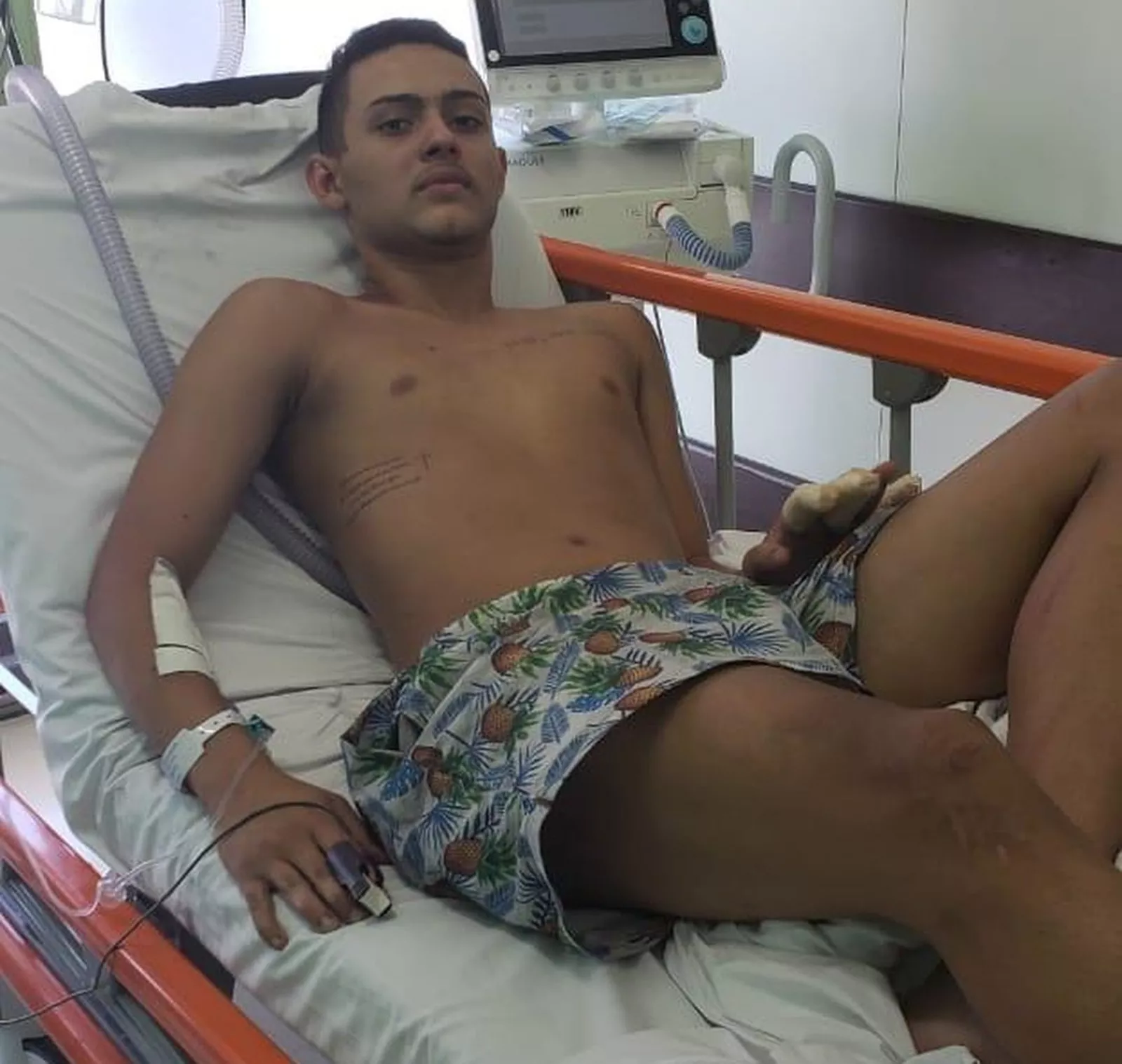 Sobrevivente de incêndio no CT do Flamengo recebe alta de hospital