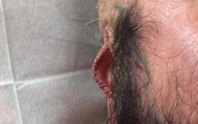 Tatuador é preso por retirar orelha de cliente mesmo com autorização