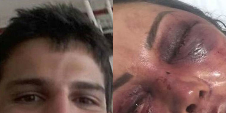 Universitário que agrediu empresária tem prisão decretada
