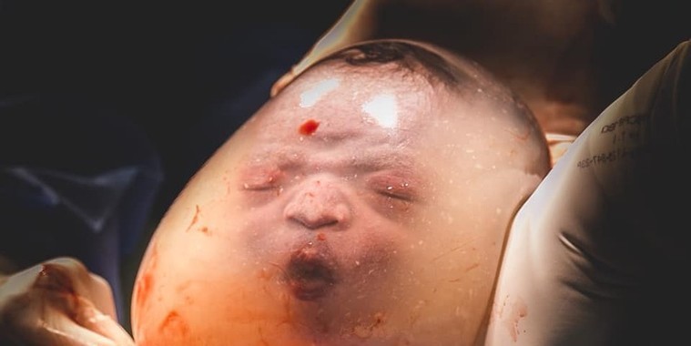 Mãe de bebê que nasceu dentro da bolsa amniótica: "presente embalado"