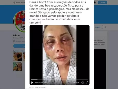 Empresária aparece com o rosto inchado e ferido em vídeo postado no Twitter Empresária aparece com o rosto inchado e ferido em vídeo postado no Twitter