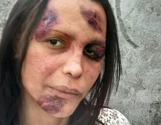 Em foto, Luisa Marilac faz protesto sobre transfobia: "7 facadas"