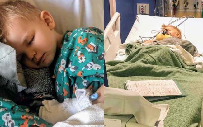 Criança de 3 anos quase morre após engasgo com pipoca e mãe faz alerta