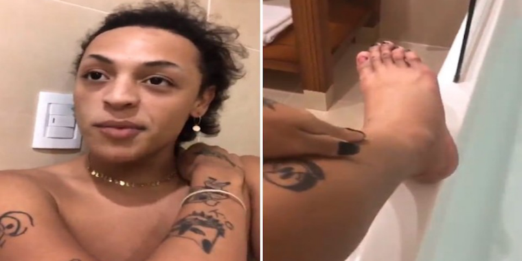 Pabllo Vittar sofre acidente e fica sem a unha do pé durante festival