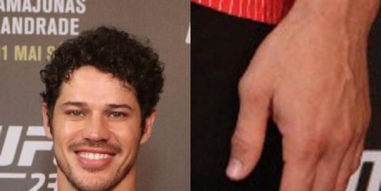 José Loreto aparece sem aliança no UFC e sai correndo da imprensa