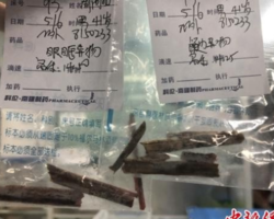 Homem descobre pedaços de madeira após sentir dores de cabeça na China