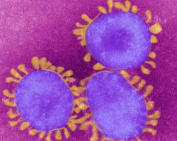Maranhense monitorada com suspeita de coronavírus será isolada em casa
