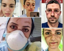 Médicos fazem selfies de como ficam após dia combatendo vírus