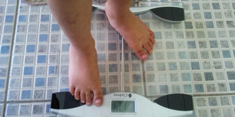 Obesidade afeta 1 em cada 5 brasileiros e pode trazer doenças graves