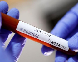 Coronavírus: Ministério da Saúde passa a contar 4 casos confirmados