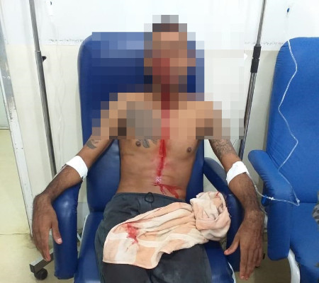 Acusado de assalto é baleado no rosto ao tentar roubar veículo de empresário