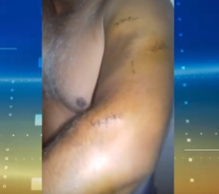 Mototaxista é esfaqueado durante assalto na zona Sul de Teresina