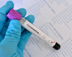 Piauí tem 19 mortes por coronavírus e 524 novos casos em 24 horas 