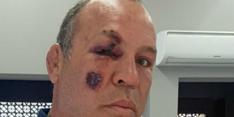 Wanderley: "Se não usasse capacete, poderia ter morrido"