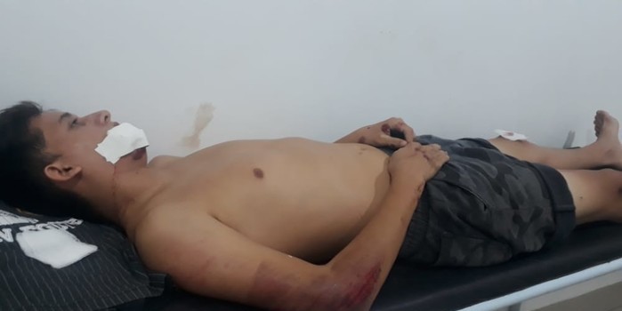 Jovem sofre acidente de moto no interior do Piauí