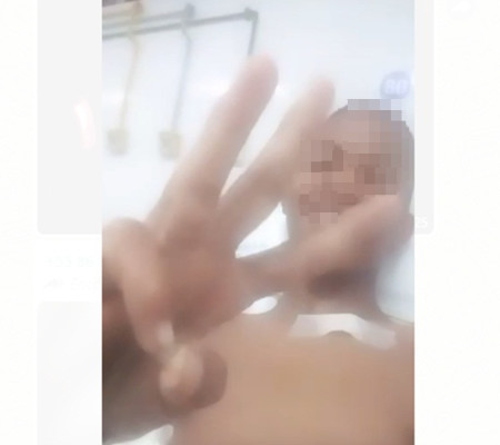 Suspeito de matar PM grava vídeo no hospital "contando" morte de policiais