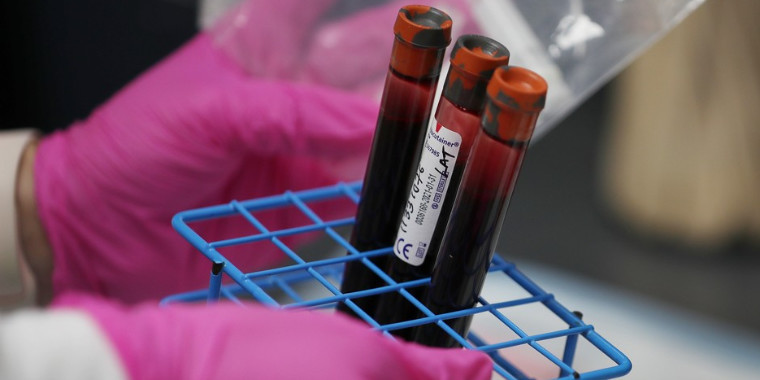 Testes rápido para a covid-19 serão distribuídos em 133 países
