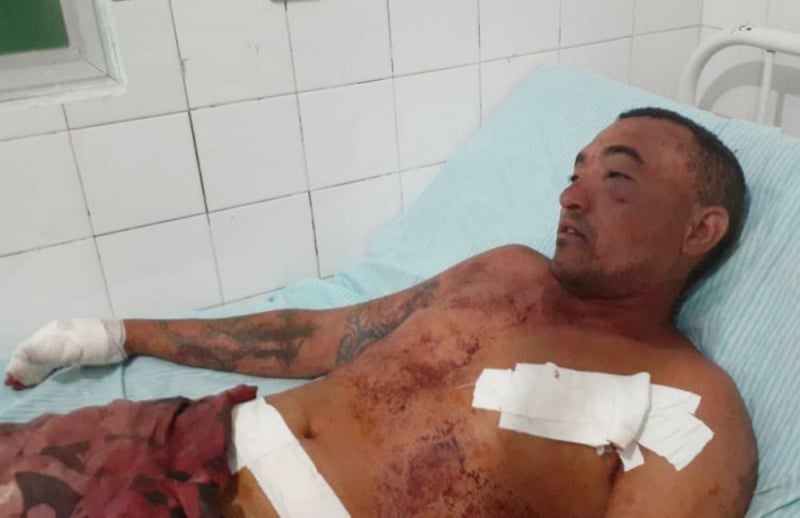 Homem sofre 5 facadas em tentativa de homicídio em Castelo do Piauí