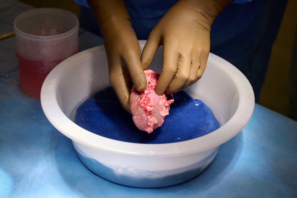 Na foto, um rim de porco geneticamente modificado é preparado para transplante em um humano nos EUA— Foto: Reuters 