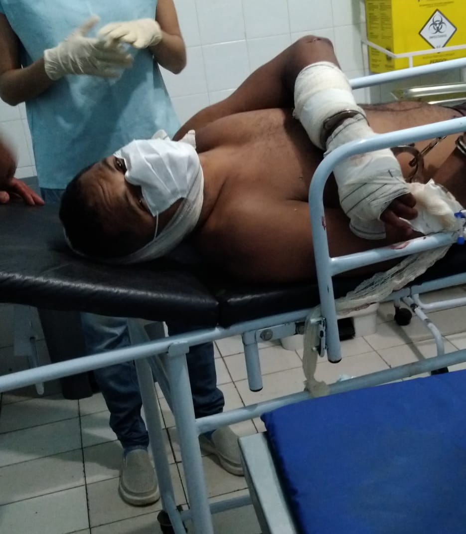 Washington Luis Barros Rodrigues também foi ferido quando lesionou as vítimas - Foto: Reprodução