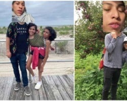 Gêmea siamesa desabafa no TikTok sobre sair em fotos da irmã com o namorado