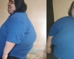 Jovem que sofre de obesidade passa dos 300 kg e não consegue mais se pesar