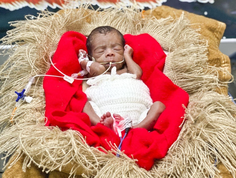 Bebês internados na UTI ganham ensaio fotográfico de Natal - Imagem 1