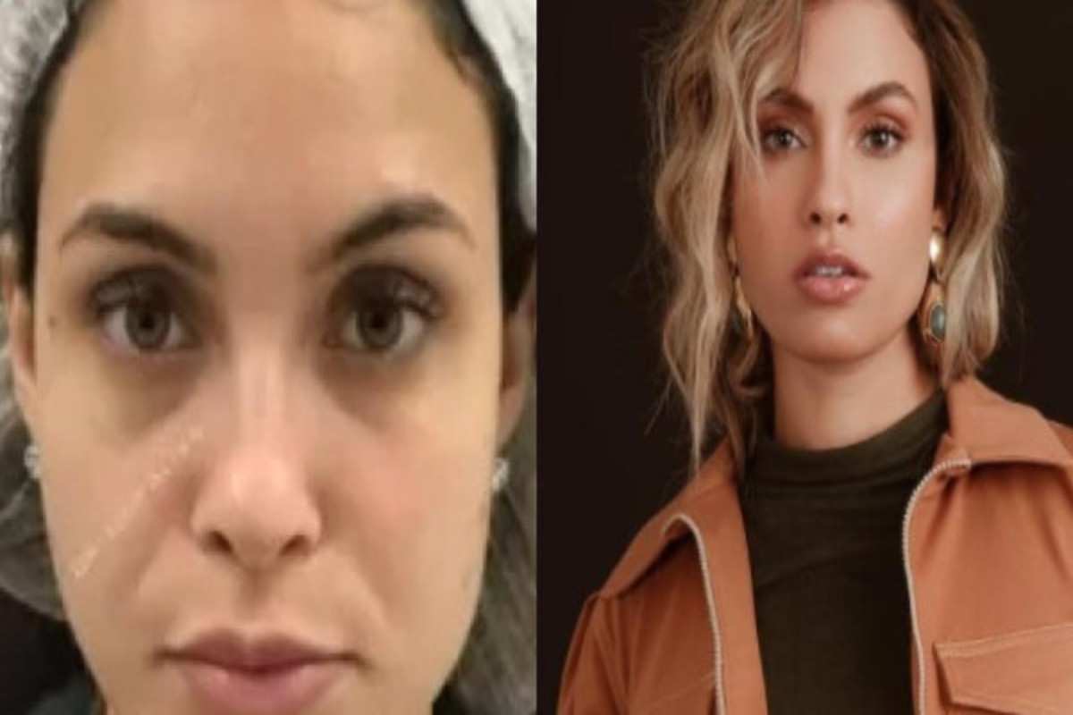 Ex-BBB Sarah Andrade faz harmonização facial; veja antes e depois -  meionorte.com