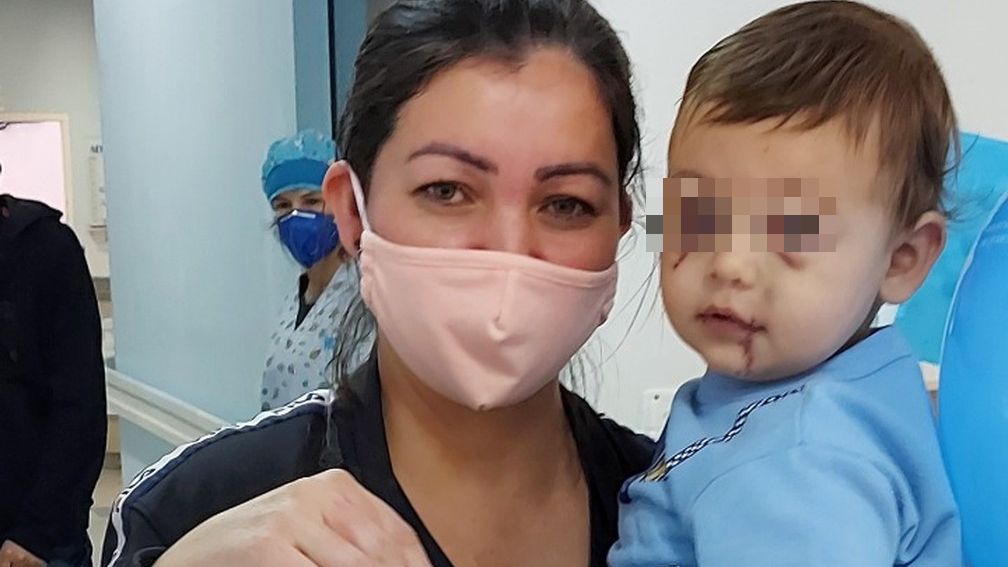 Unico Bebe Que Sobreviveu A Ataque De Cheche De Sc Recebe Alta Hospitalar Meionorte Com