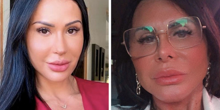 Gretchen se surpreende com resultado de nova cirurgia plástica