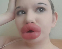 Jovem búlgara pretende ter os maiores lábios do mundo
