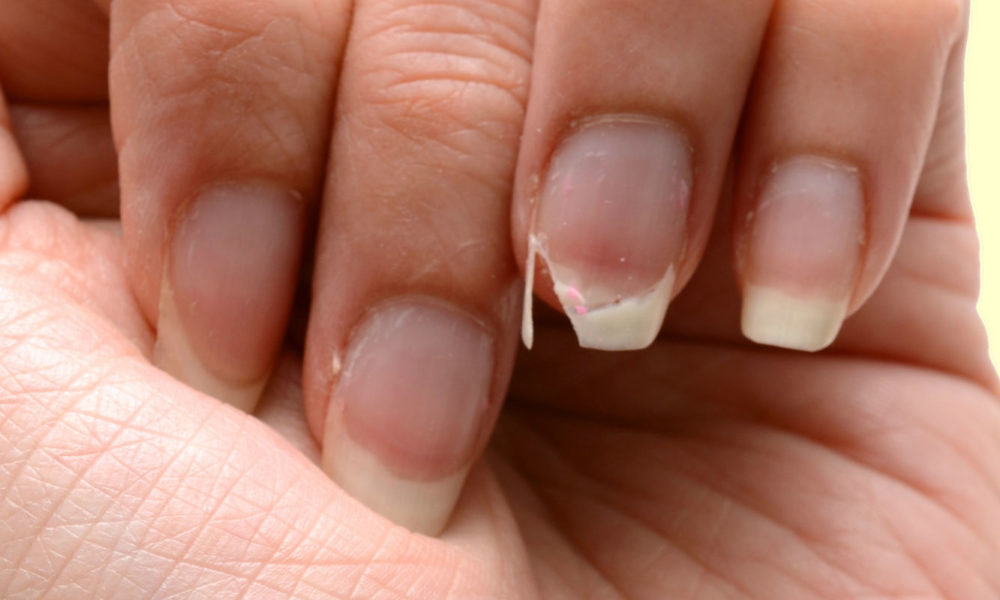 Descubra o que as unhas podem indicar sobre a sua saúde Descubra o que as unhas podem indicar sobre a sua saúde