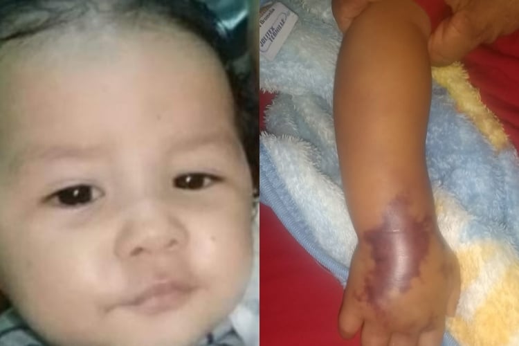Bebê morre após contrair infecção devido suposto erro em hospital de Barras (Foto: Divulgação)
