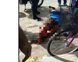 Mulher é baleada na cabeça em tentativa de feminicídio em Teresina; vídeo