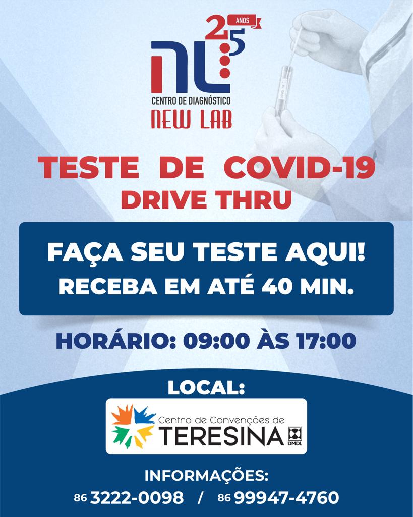 Centro de Convenções de Teresina conta com posto de testagem para Covid-19 - Imagem 2