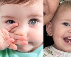 Retinoblastoma: saiba identificar os sinais do câncer da filha de Leifert