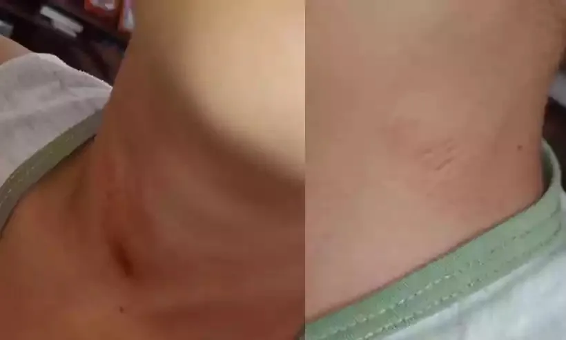 Mãe diz que criança foi enforcada por PM após dizer “Lula lá” (Foto: Reprodução)