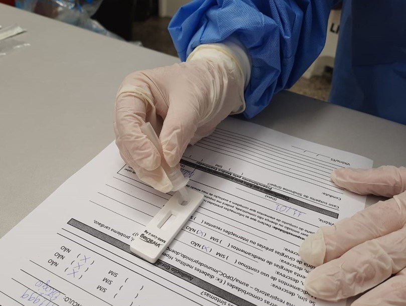 Teresina volta a registrar aumento aumento na taxa de positividade  nos testes de Covid-19 