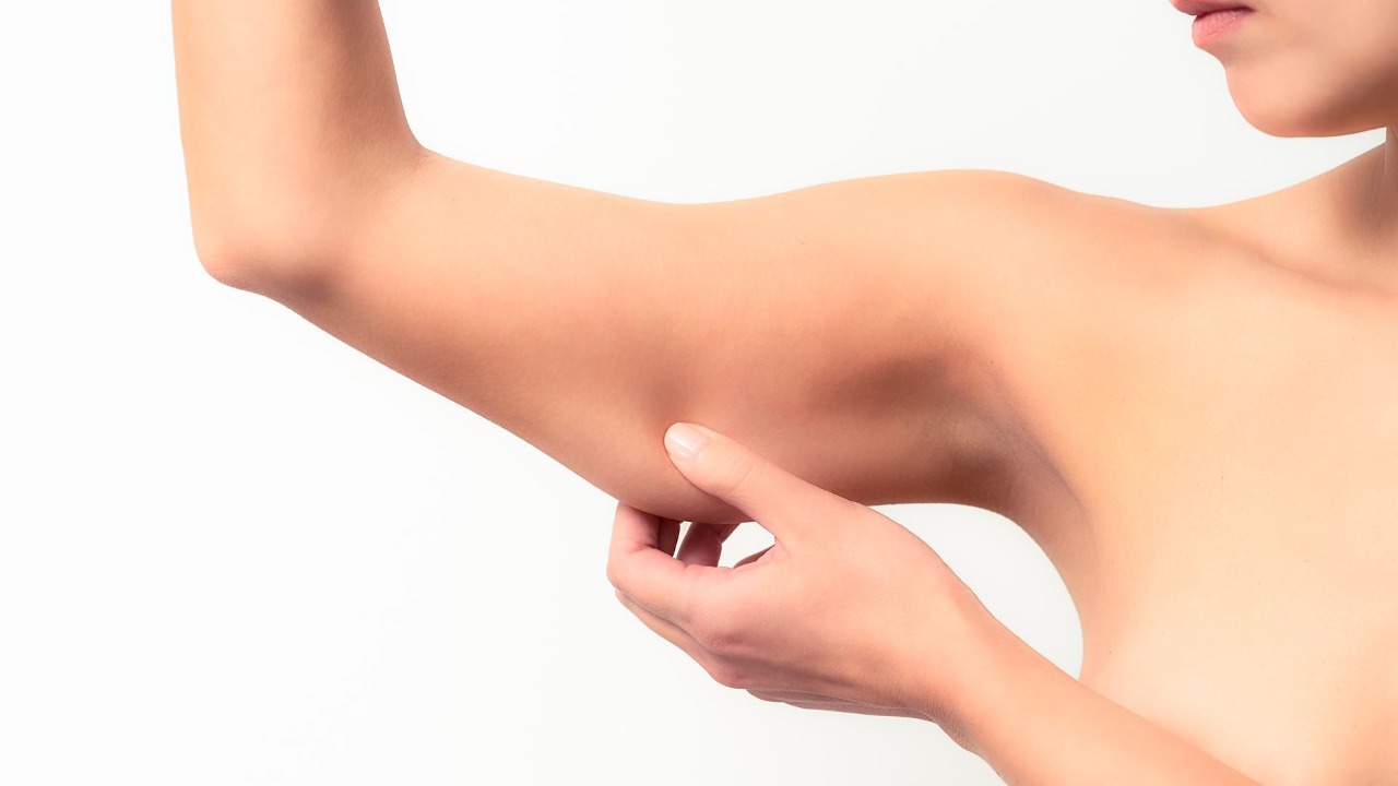 Braquioplastia, a cirurgia que acaba com o excesso de pele nos braços - Imagem 2