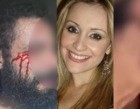 Médica que mandou cortar pênis do ex-noivo é acusada de agredir marido